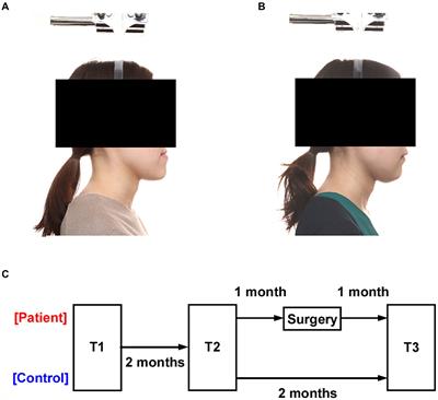 Changes in facial appearance alter one’s sensitivity not only to the self but also to the outside world